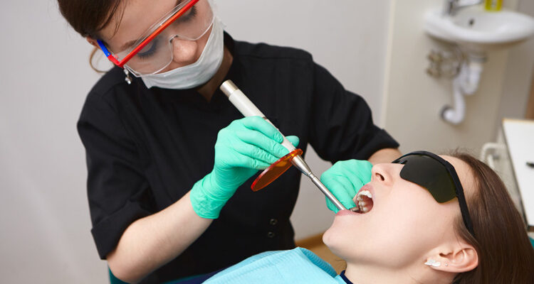 Dental fillings citi dental blog
