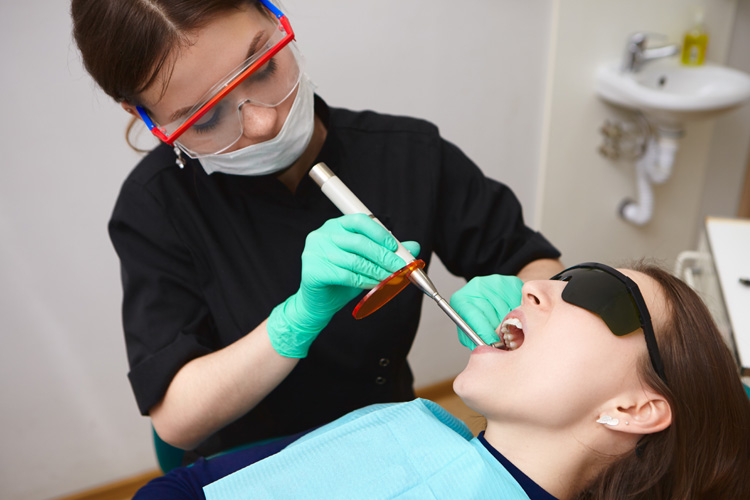 Dental fillings citi dental blog